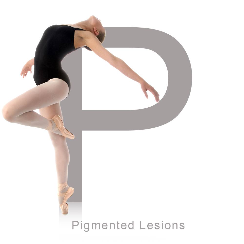 Pigmented Lesions